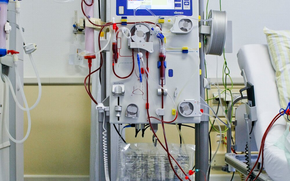 Filter unit with scale to keep the fluid balance under control Filter unit with scale to keep the fluid balance under control